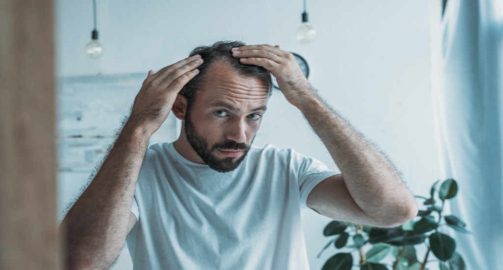 5 ways to prevent hair loss at an early stage in life