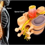 Why are Humans More Prone to Spinal Problems?