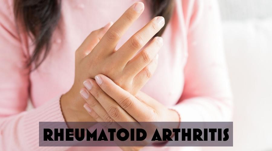 RHEUMATOID ARTHRITIS